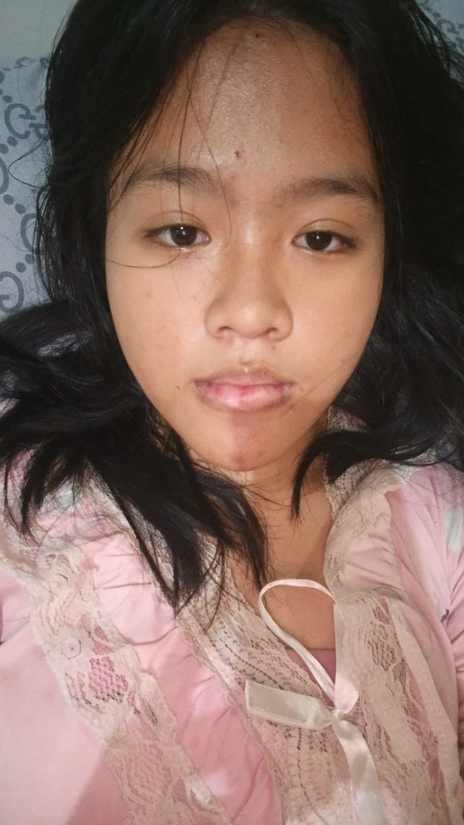 Bee 🐝🍯 tweet media