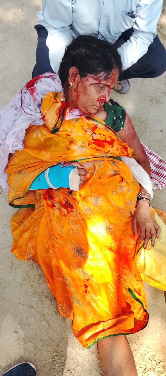 SuchitTiwari092's tweet photo. @PMOIndia @MoHFW_INDIA @myogiadityanath @CMOfficeUP @UPGovt @AyushmanNHA @dghsindia
@CMO_VARANASI 
@Varanasi_DM
मैं वाराणसी जनपद के बड़ागांव ब्लॉक, कूड़ी ग्राम सभा का निवासी हूँ। अत्यंत दुख के साथ निवेदन है कि मेरी माँ (उम्र 58 वर्ष) का अचानक एक्सीडेंट हो गया, जिसके इलाज में... https://t.co/vSqbap1qgP