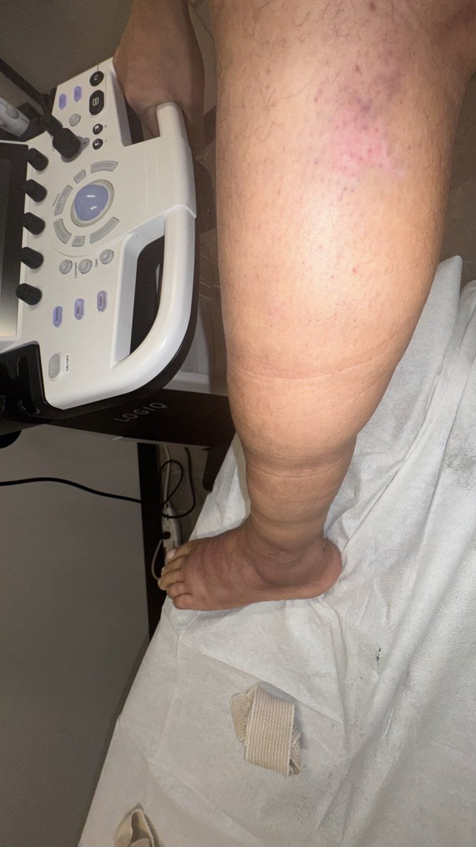 FugaziFoobar tweet media