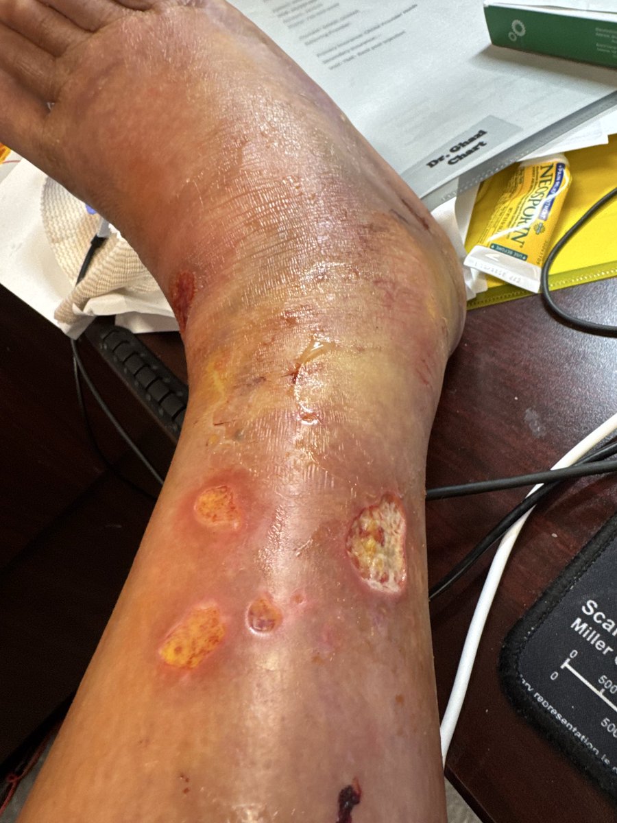 FugaziFoobar tweet media