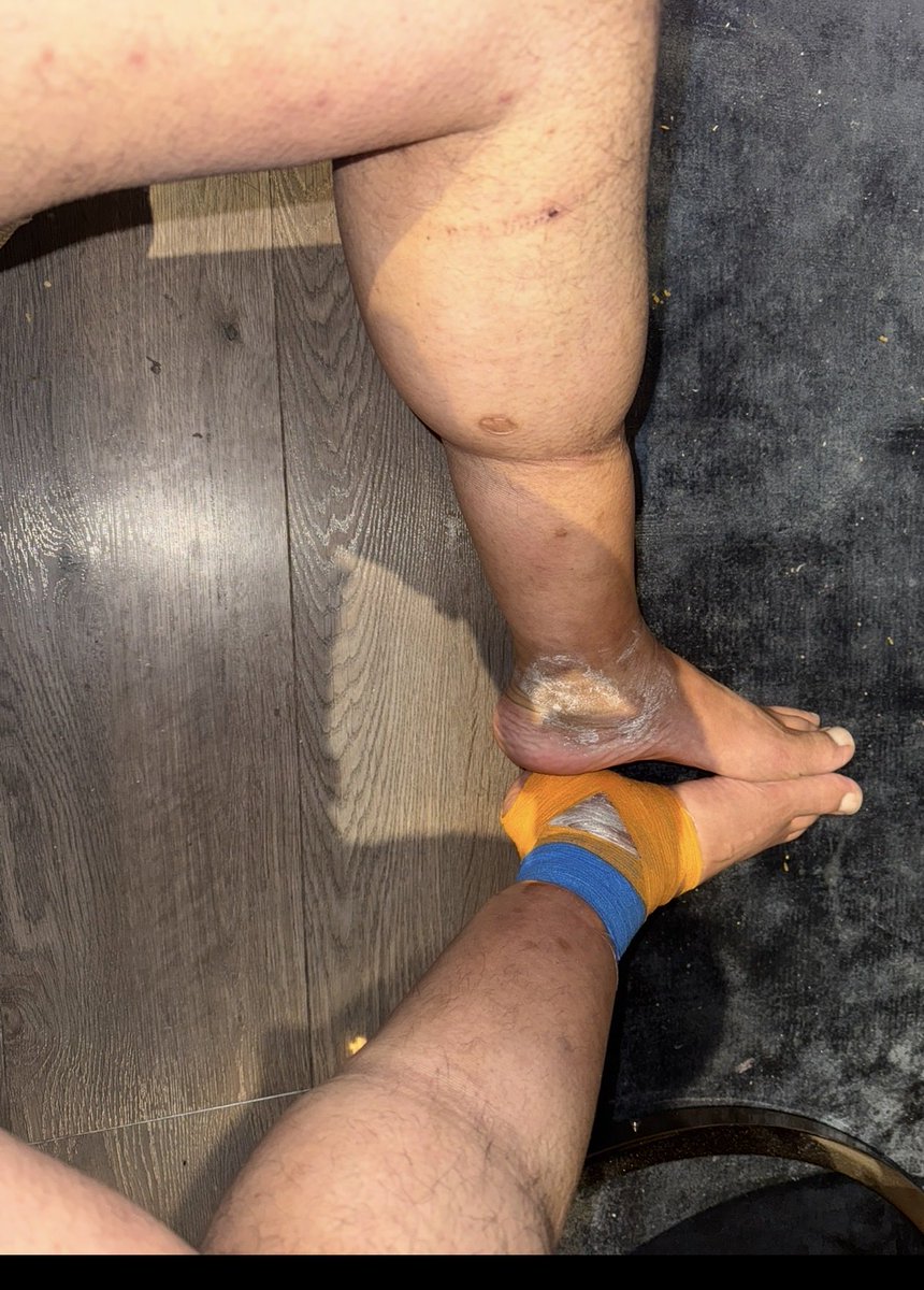 FugaziFoobar tweet media