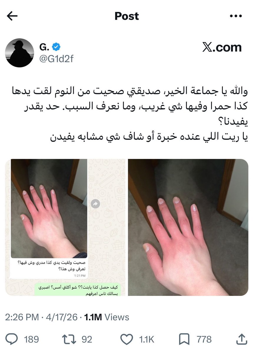 ابو اصىيل| صلوا على النبي ﷺ tweet media