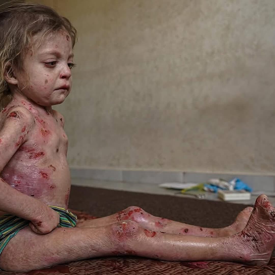 茶葉🍉 tweet media