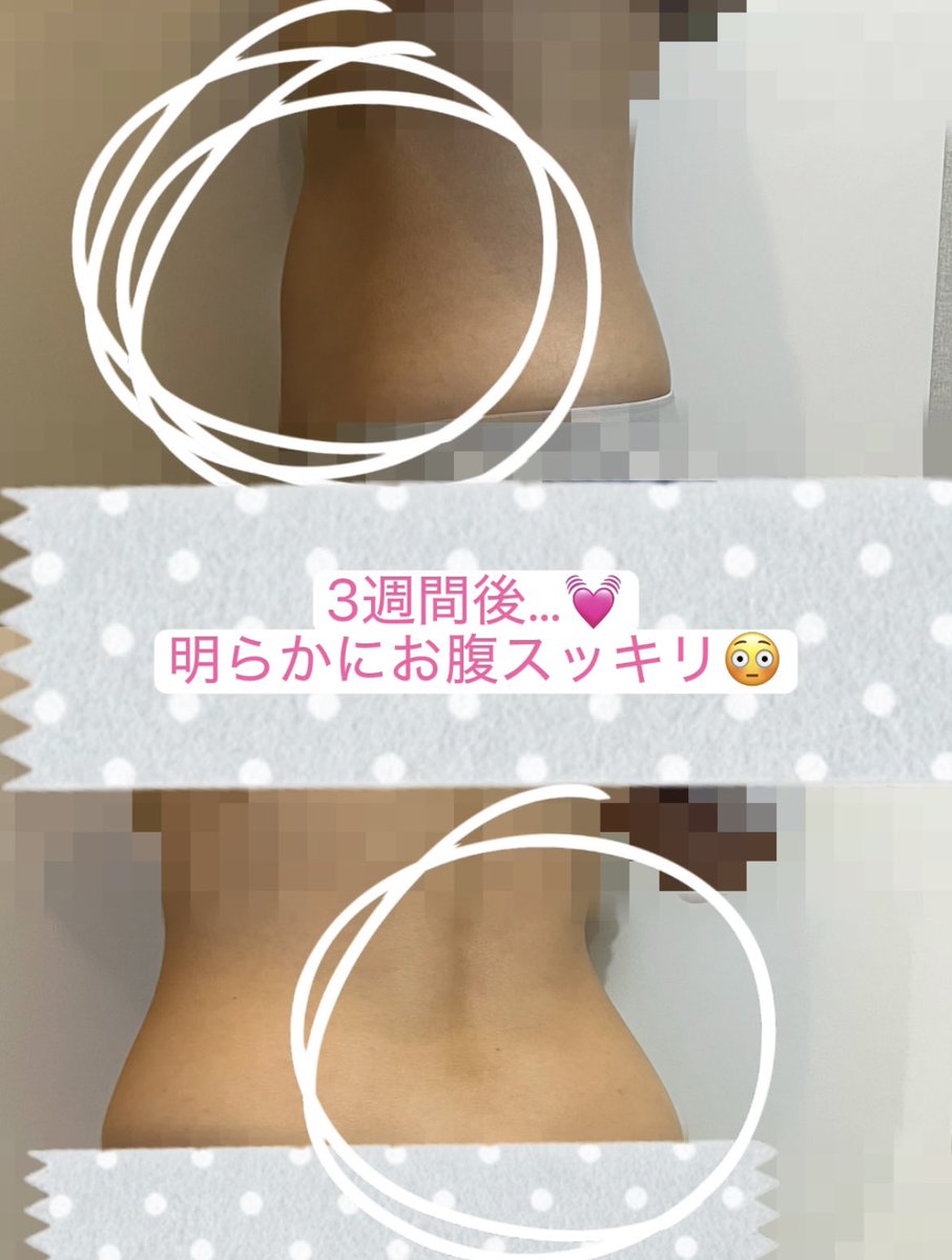 mari-na🧚3月渡韓✈️美容・コスメ・肌管理💄✨ tweet media