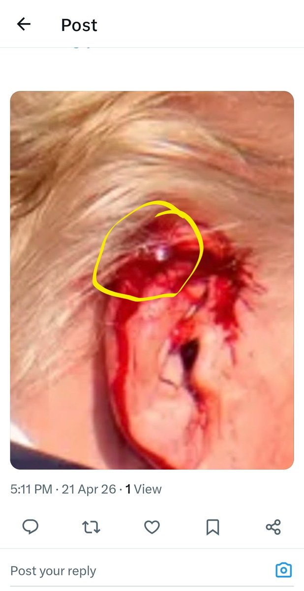 ChristopherRoberts14 🛹 tweet media