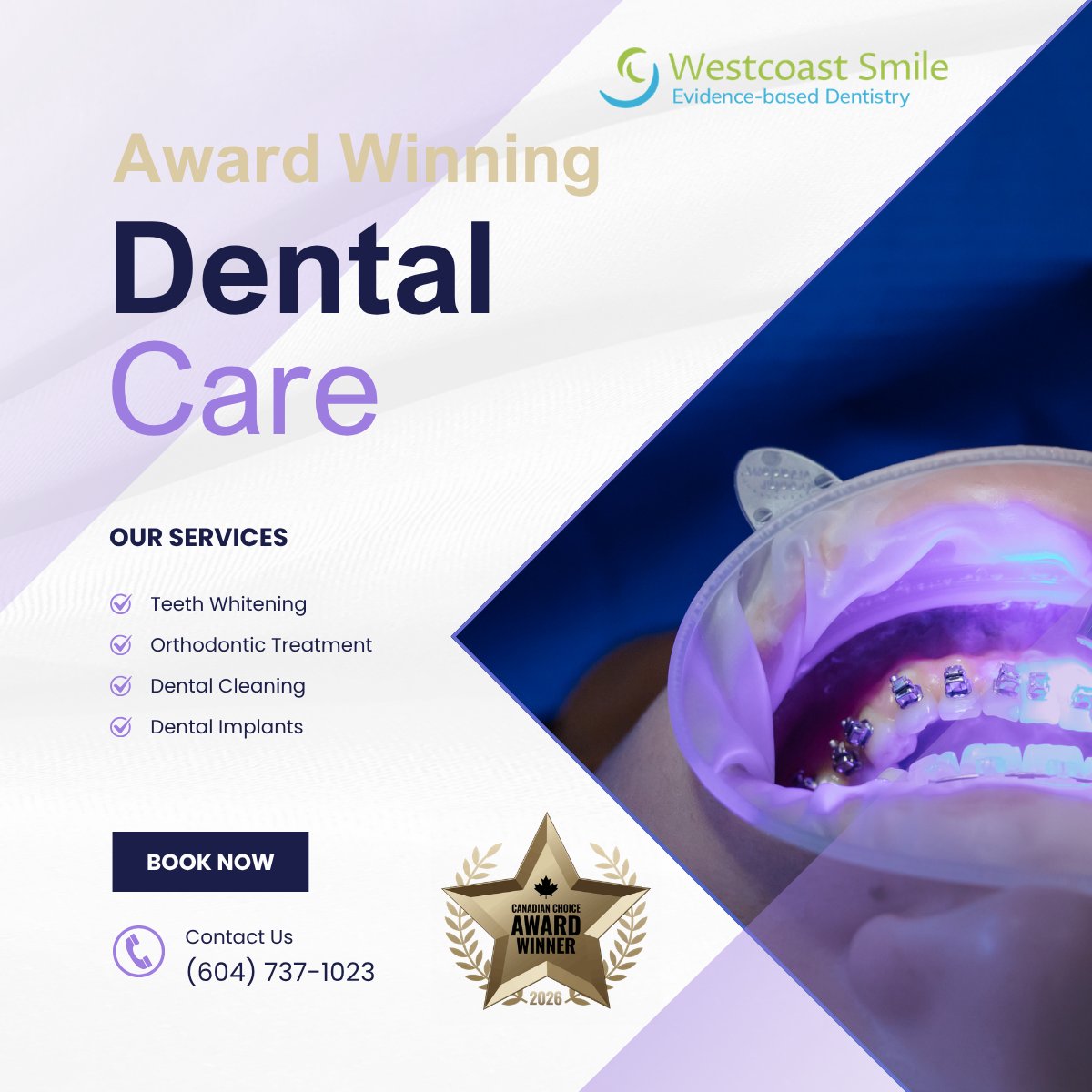 westcoast_smile's tweet image. Award-winning dental care in Vancouver 🦷
Whitening • Cleaning • Orthodontics • Implants
📞 (604) 737-1023
🌐 westcoastsmile.com/dental-service…

#Vancouver #Dentist #SmileCare