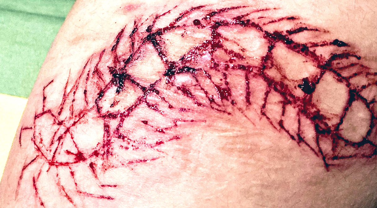 ( ˶°ㅁ°) !! tweet media