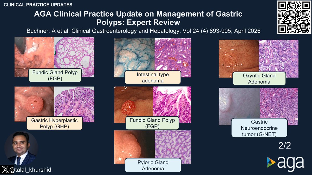 #CGH4ALL @AGA_CGH 📣 ⚠️ Gastric polyps are markers, not just lesions ...