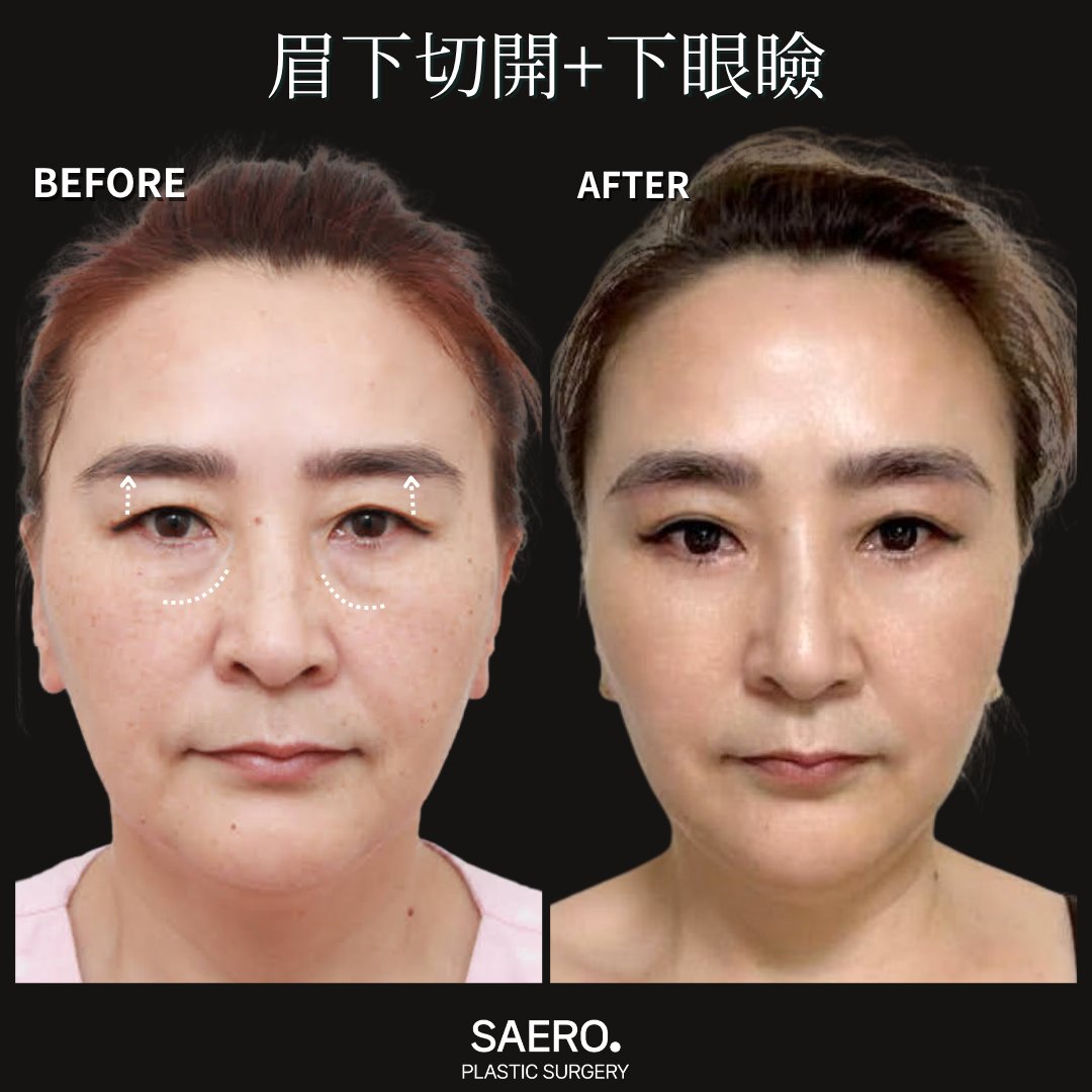 セロ美容外科 tweet media