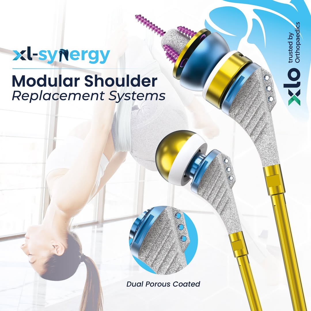 xlortho's tweet image. Designed for Complexity. Delivering Simplicity in Motion.
#Orthopedics #ShoulderSurgery #ShoulderReplacement #MedicalDevices #MedTech #HealthcareInnovation #SurgicalPrecision #OrthopedicSurgeon #JointReplacement #FractureCare #Reconstruction #Biomechanics #MobilityMatters