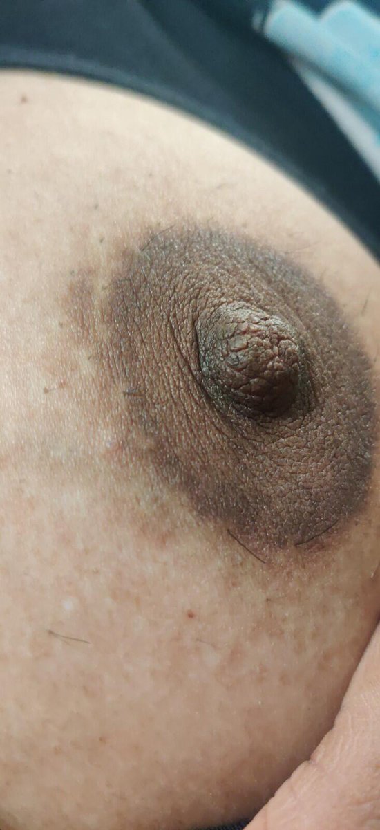 MALLU FANTASY tweet media