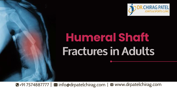 What is a Humerus Shaft Fracture?

A humerus shaft fracture is when you manage to break or fracture the middle part of your humerus bone. This type of fracture is considered to be the simple humerus injury. Depending on the severity, a maximum of 12-14.

drpatelchirag.com/blog/humeral-s…