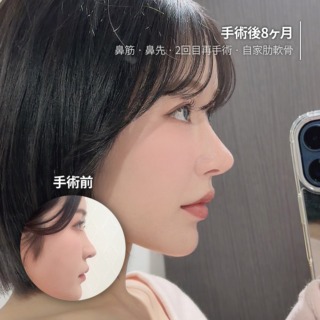 ルーヴル美容外科 tweet media