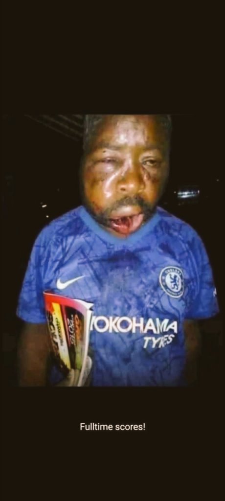 ab2e4's tweet photo. @OfficialBHAFC @ChelseaFC Beaten black and blue https://t.co/5MNeWooieA