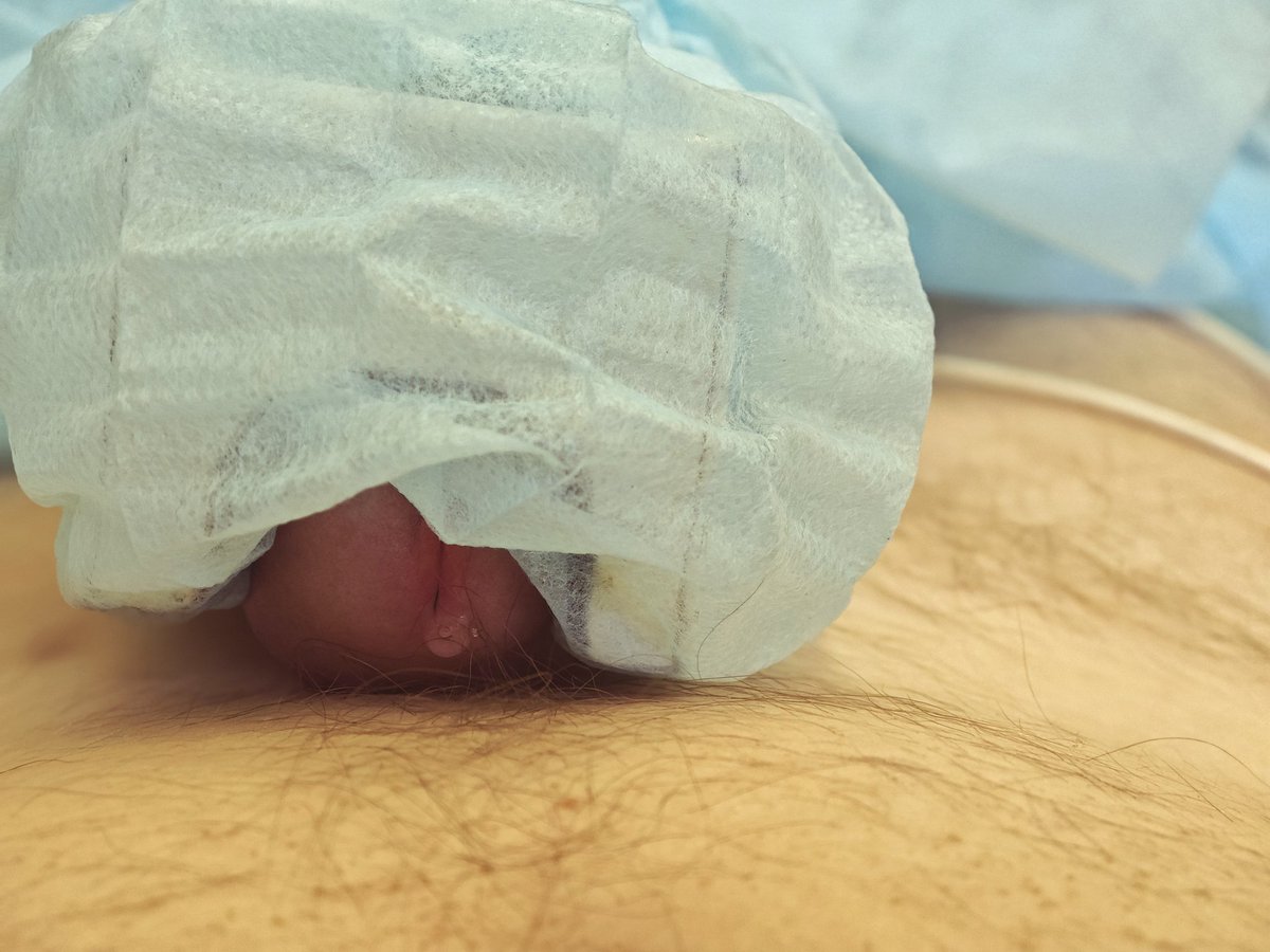 V U L P 1 S tweet media