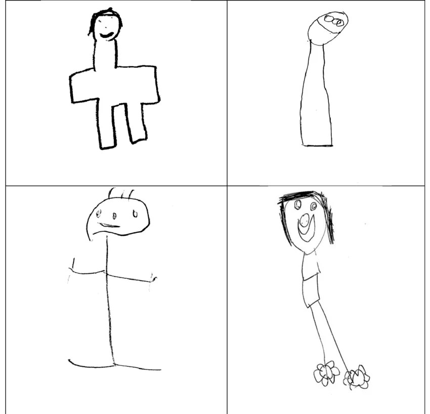 ElPaido's tweet photo. El test de dibujo de figura humana parece inofensivo, pero cuando se usan para diagnosticar psicopatología o peor "ubicar la inteligencia", el margen de error no es pequeño: es inaceptable.

La evidencia muestra tasas de mala clasificación de 56 a 65% del dominio conceptual. En la práctica, esto puede traducirse en decisiones educativas equivocadas o diagnósticos erróneos.

Un problema clave es que, muchas veces, no se evalúa el estado psicológico sino la habilidad para dibujar. Incluso cuando se advierte a los clínicos, el sesgo hacia la calidad artística persiste, afectando la interpretación. Así, un niño con poca destreza gráfica puede parecer “problemático”, y uno con buena habilidad puede enmascarar dificultades reales.
A esto se suma una ambigüedad de base: un mismo rasgo en el dibujo puede interpretarse de formas distintas, favoreciendo subjetividad, sesgos de confirmación y sobreinterpretación de variaciones normales o culturales.

El punto crítico no es el dibujo como recurso clínico complementario, sino su uso como herramienta diagnóstica autónoma. Ahí es donde la evidencia no respalda su validez y donde el riesgo ético aparece: decisiones clínicas, educativas o incluso legales (les encanta a los abogados y jueces) basadas en datos poco fiables.

La pregunta no es si debemos dejar de usar dibujos en clínica, sino si estamos dispuestos a dejar de darles un peso que no pueden sostener.

Imuta et al., 2013 (PLoS One); Thomas & Jolley, 1998 (Br J Clin Psychol); Feher et al., 1983 (J Clin Psychol); Bekhit et al., 2005 (Psychol Psychother); Matto, 2002 (Psychol Assess).