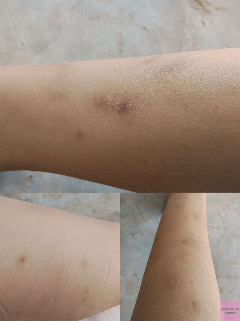 YAPPINGFESS tweet media