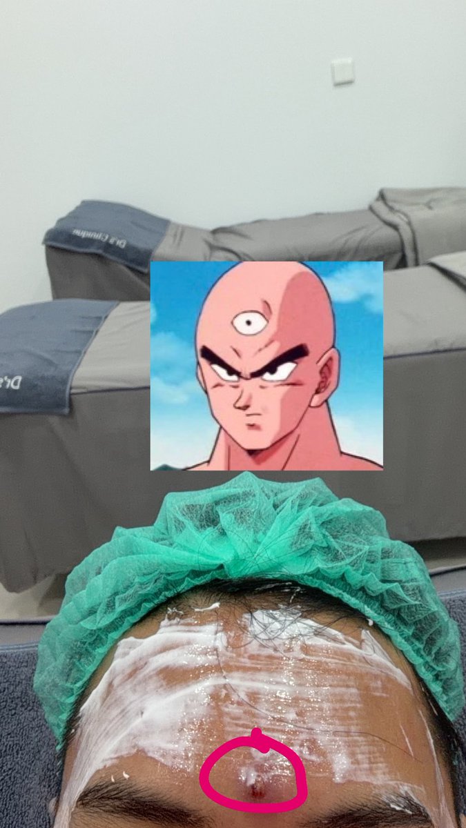 PingPing tweet media