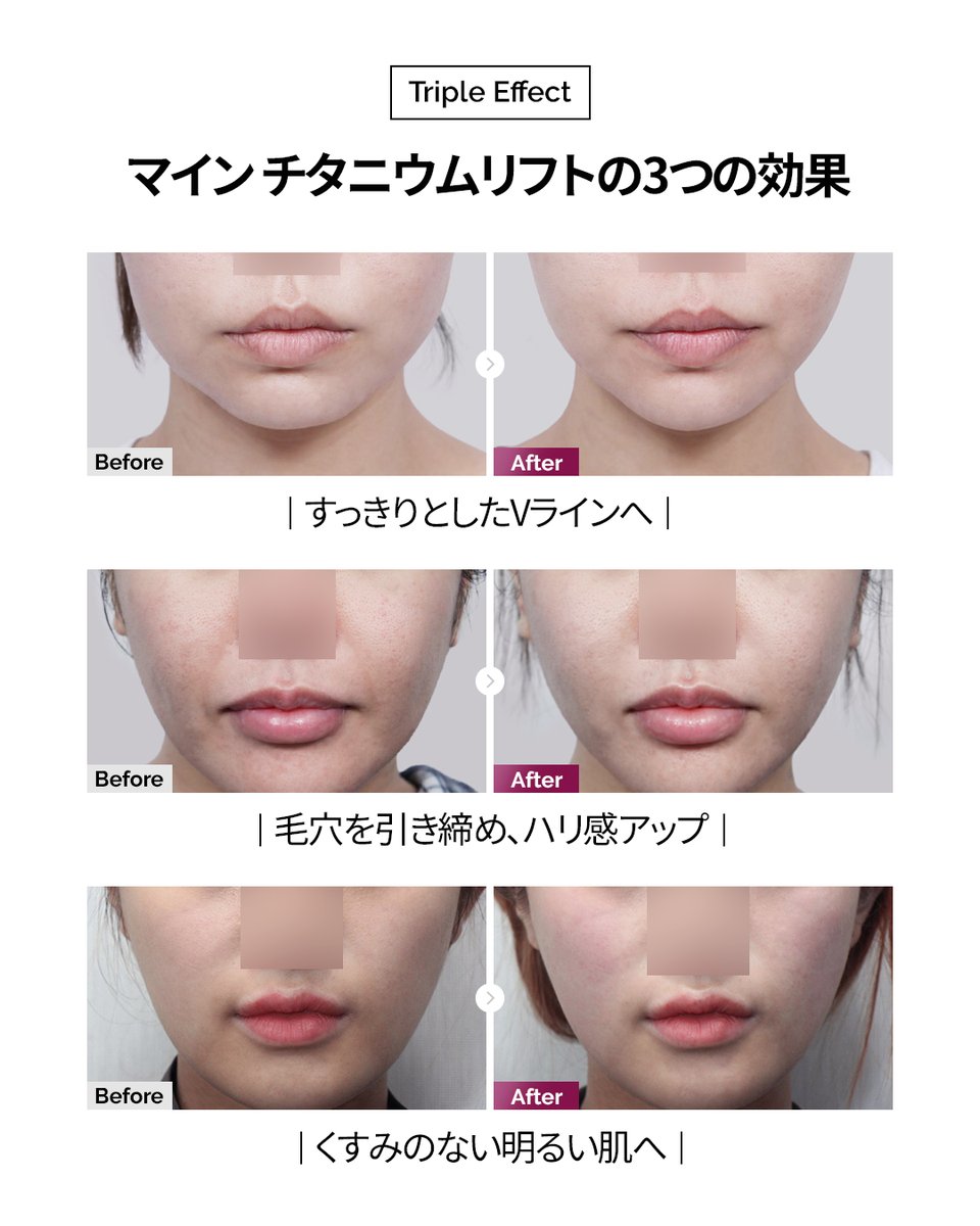 マイン美容外科・皮膚科 tweet media