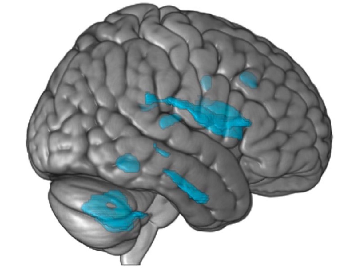 Müzik dinlemek veya yeni bir müzik enstrümanı öğrenmeye çalışmak, beyindeki gri maddenin üretimini uyarır. Yaşlılığa bağlı bilişsel gerileme ve hafıza kaybını önleme konusunda olumlu etki yapar.