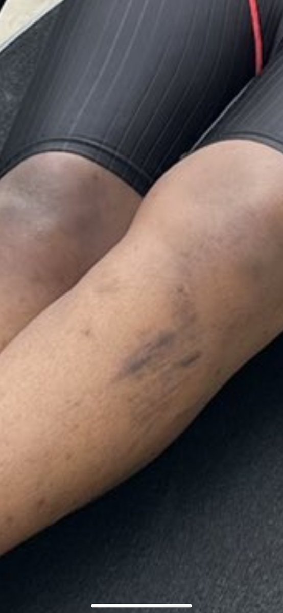 WARD’99 tweet media