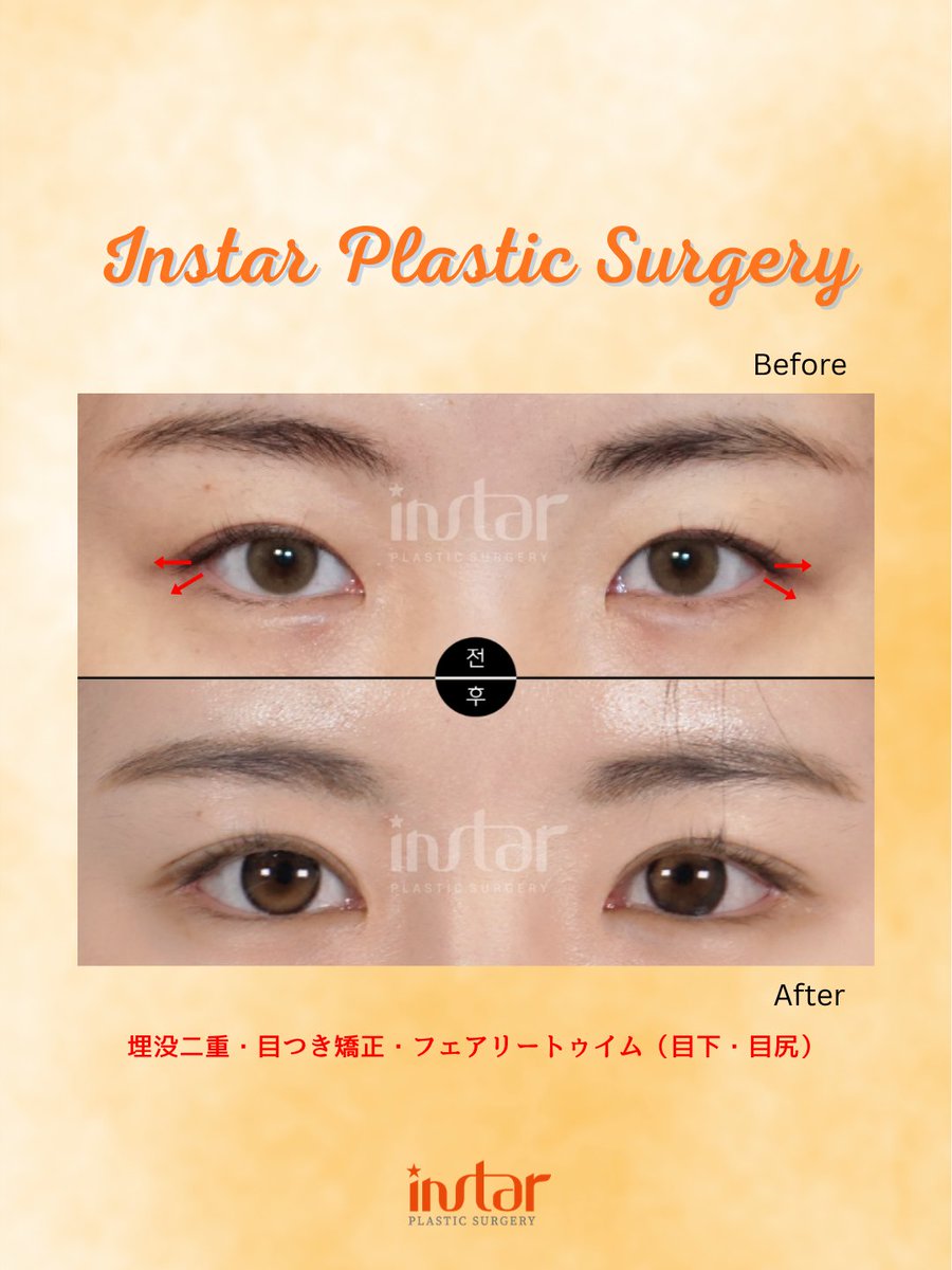 ⭐️instar整形外科⭐️ tweet media