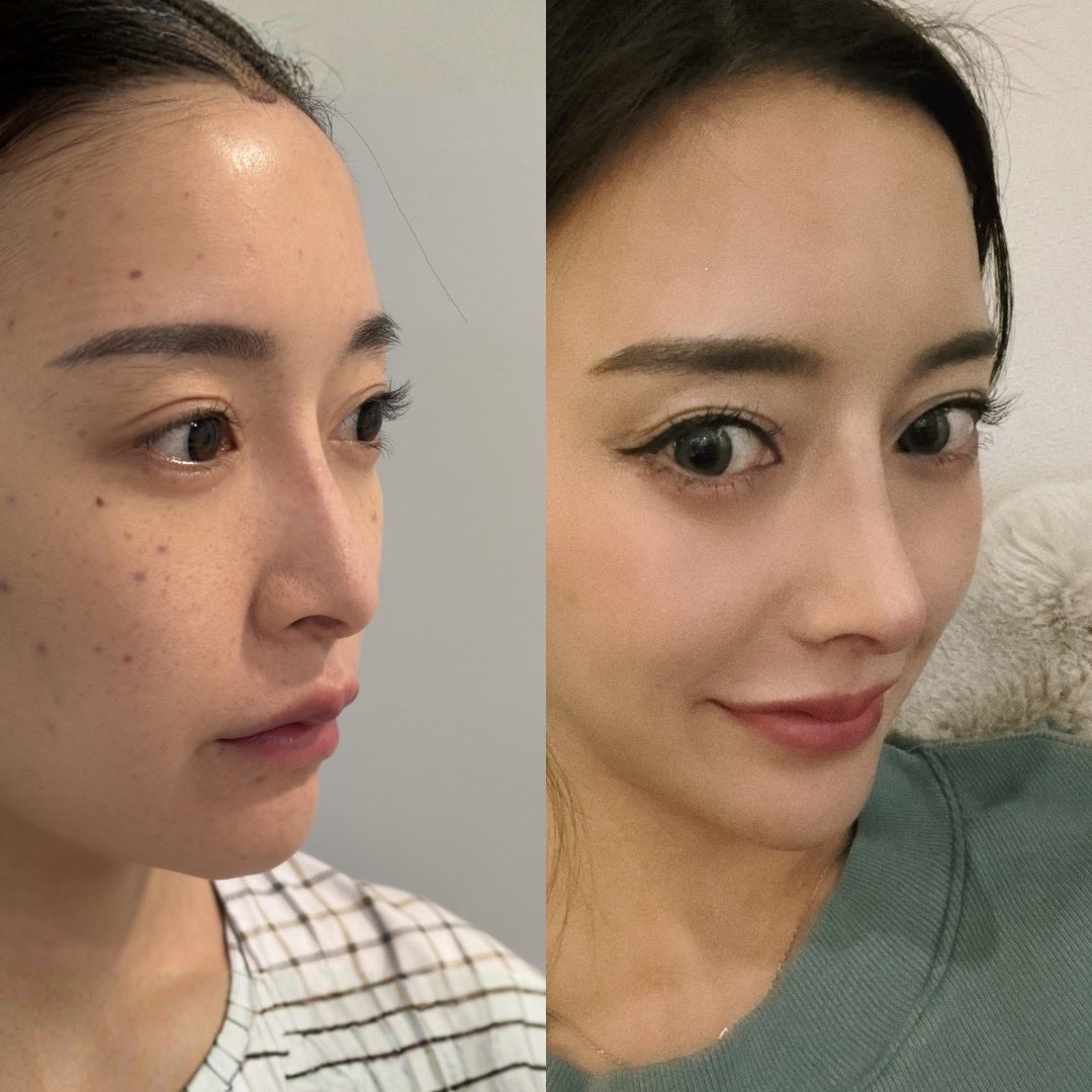 アラサー美容オタク🥴ピピ🐥 tweet media