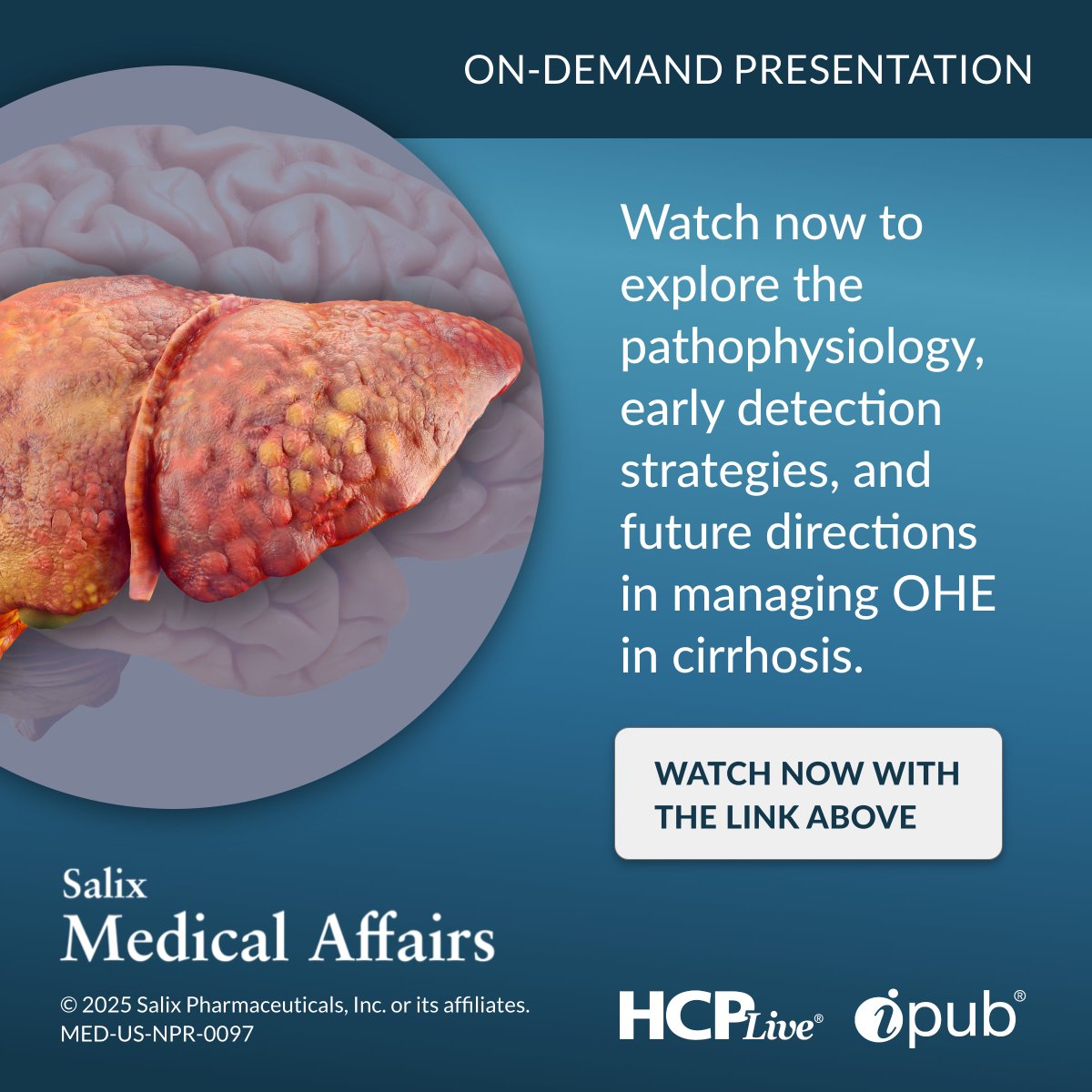 HCPLiveNews's tweet photo. Discover unmet clinical needs, novel biomarkers & emerging treatments shaping the future of care for overt hepatic encephalopathy in cirrhosis.
Watch Now: https://t.co/VaR1eybwvR
#Cirrhosis #LiverDisease #OHE https://t.co/yjG4LdjfJF