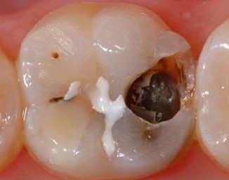teethondooty tweet media