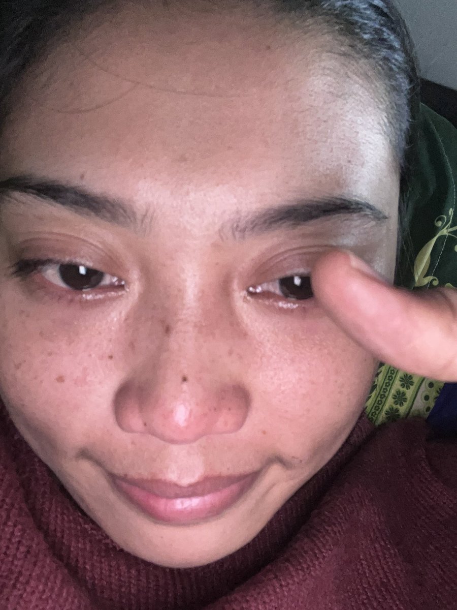 ayyaka_'s tweet photo. 2 minggu setelah ngambil keputusan besar buat hdp gwell, kena mental breakdown 😞☝🏻 https://t.co/LJHAYe0Say