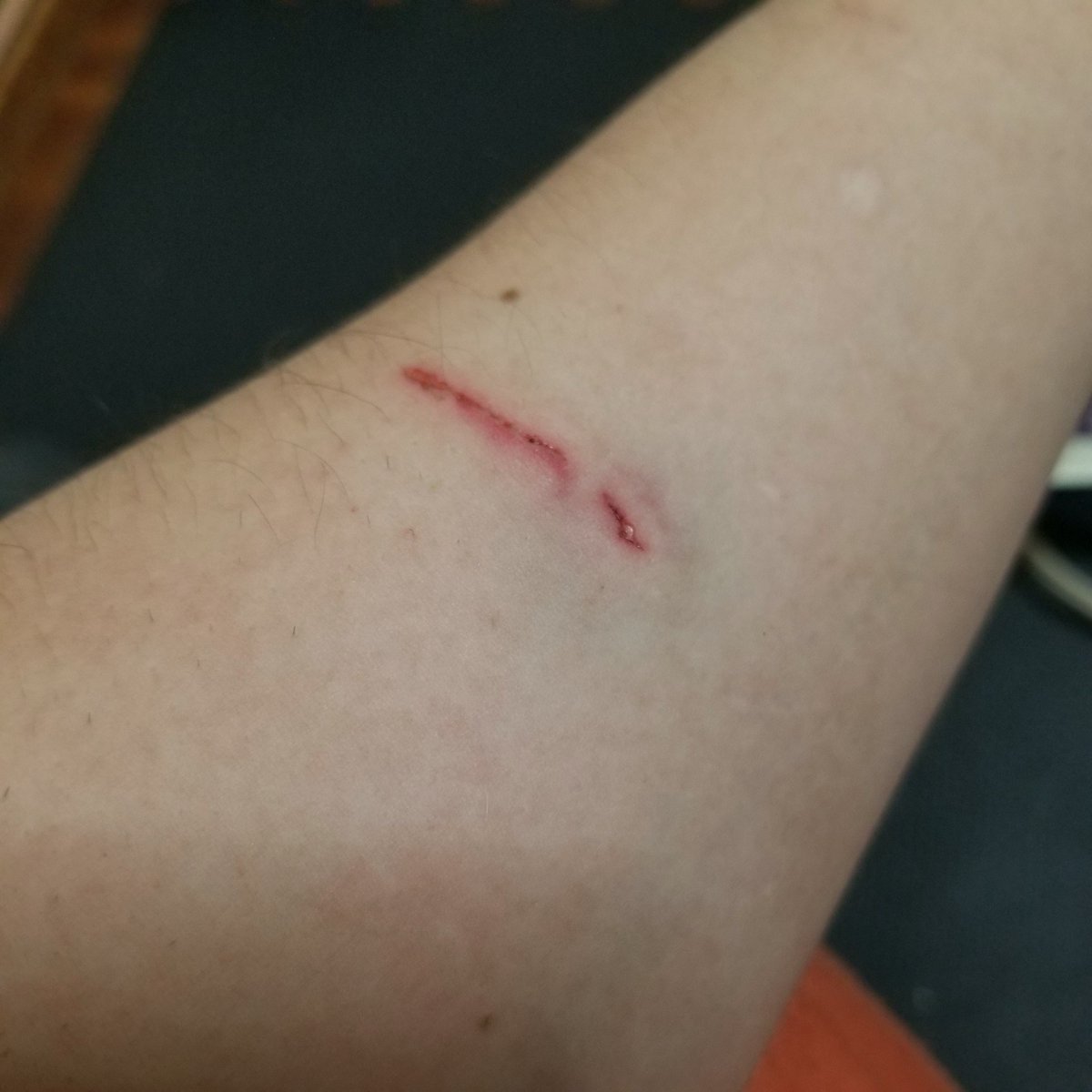 ぱげだもん tweet media