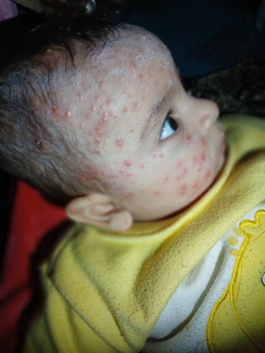 Yousef in Gaza 🇵🇸 tweet media