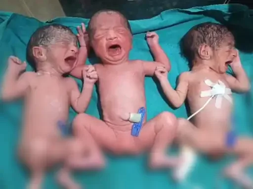 DeshbandhuMp's tweet image. सिवनी में महिला ने एक साथ तीन बच्चों को दिया जन्म
deshbandhump.com/post/woman-giv…
#Seoni #MadhyaPradesh #Triplets #MedicalMiracle #HealthNews #NewBorn #SeoniNews #SuccessStory #MedicalAchievement
@healthminmp  @collectorseoni1  @MoHFW_INDIA