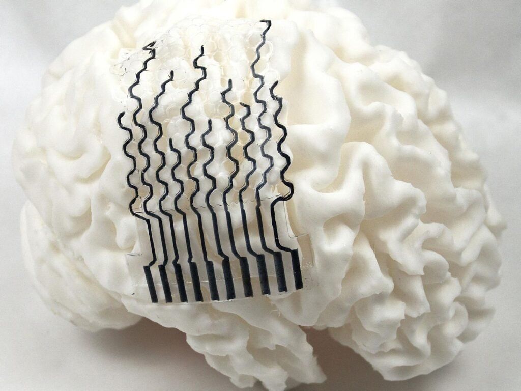 GizmoMD_'s tweet image. 3D Printed Brain Sensors Offer a New Path Toward Personalized Neural Monitoring - gizmo.md/2026/04/22/3d-… #medtech