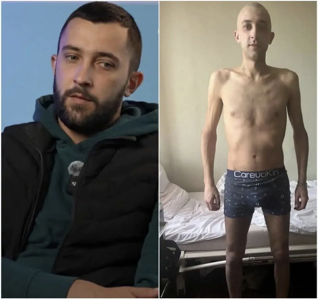 Ukrainian border guard Yevhenii Sholudko lost 30 kg in russian captivity.

This is not prison — it’s torture:

“They flayed the skin off my back — I have a scar the length of my spine.”

No clothes. No windows. No toilet. Beatings. Starvation

This must not go unpunished.