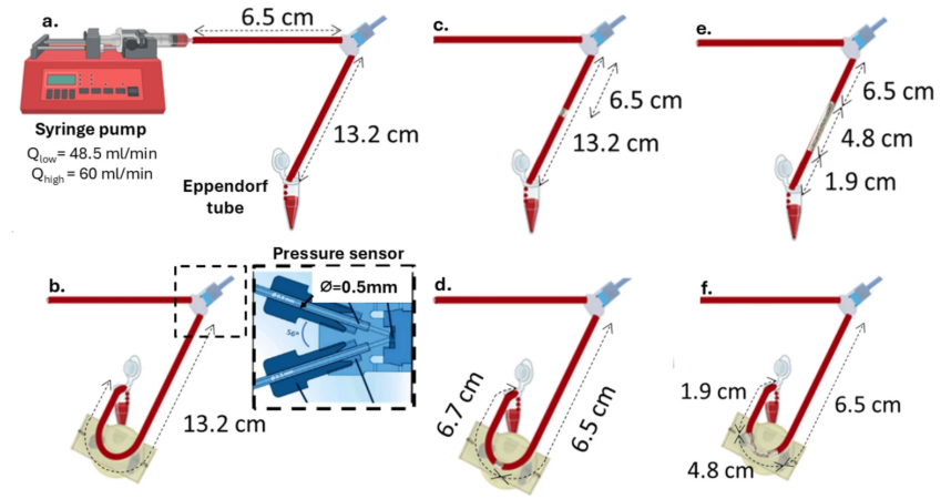 CVET_Journal's tweet image. How do stents impact blood flow and properties? This CVET study explores hemodynamic and hematological changes.

Read more: hubs.la/Q04b3VY10

#BiomedicalEngineering #Stents #Hemodynamics #MedTech