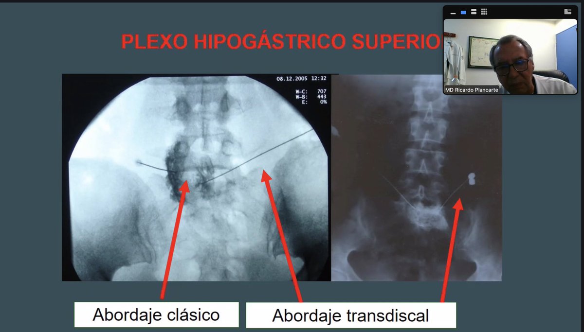 Pain Institute of Spain tweet media
