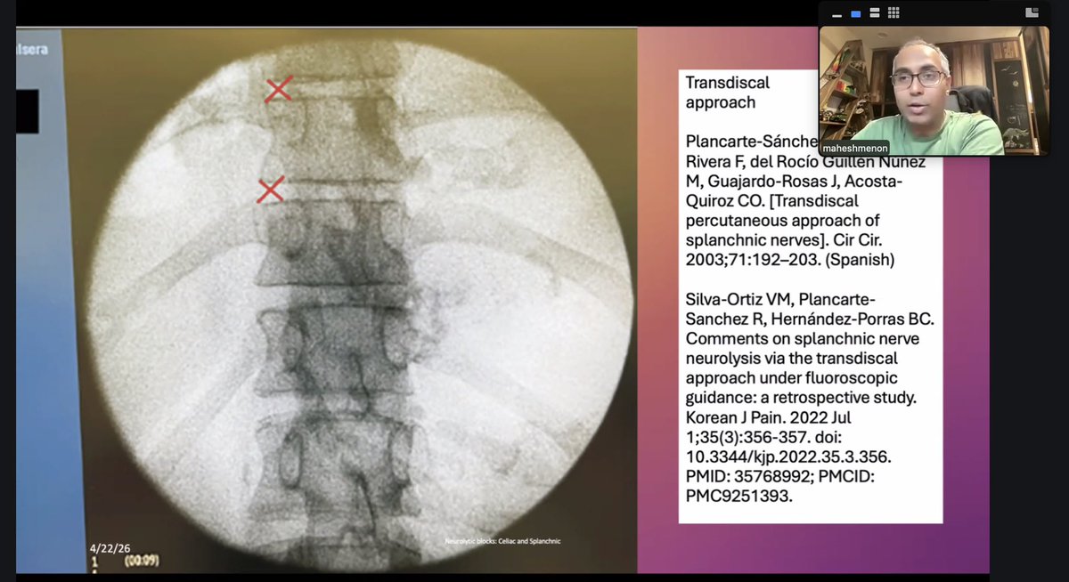 Pain Institute of Spain tweet media
