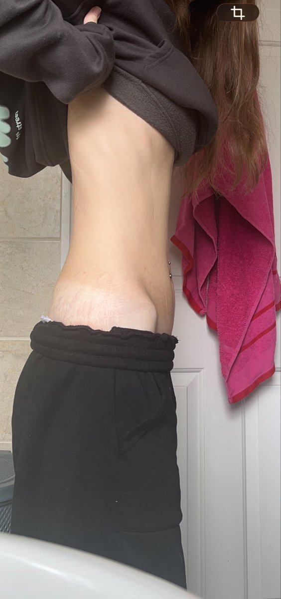 emi || day 3 binge free tweet media