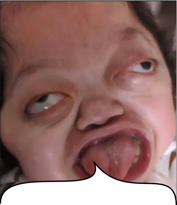 Lionel Fernández tweet media