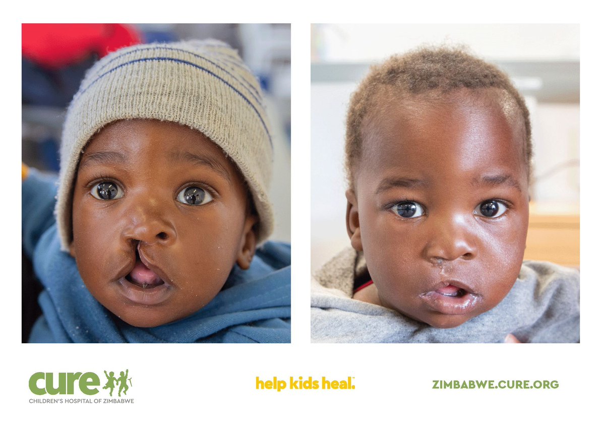 CURE Children's Hospital of Zimbabwe tweet media