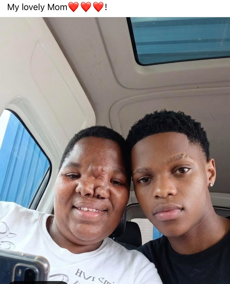 Please never be ashamed of your parents no matter what ❤️🥹🙏