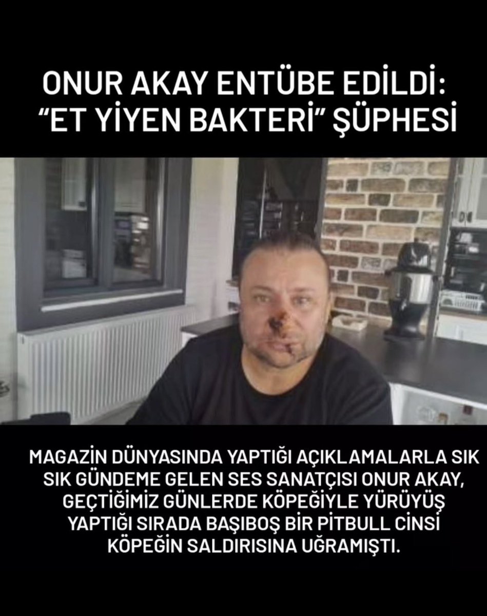 BulutGulcuN's tweet photo. Geçen hafta #pitbul saldırısına uğrayan sanatçı Onur Akay, et yiyen bakteri bulaşı şüphesiyle yoğun bakıma yatırılarak entübe edilmiş. 
#sokaktaetoburolmaz https://t.co/kG3sbHwBTw