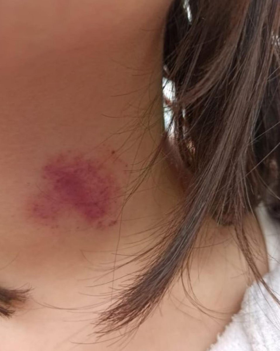 ɪʟɢɪɴ tweet media