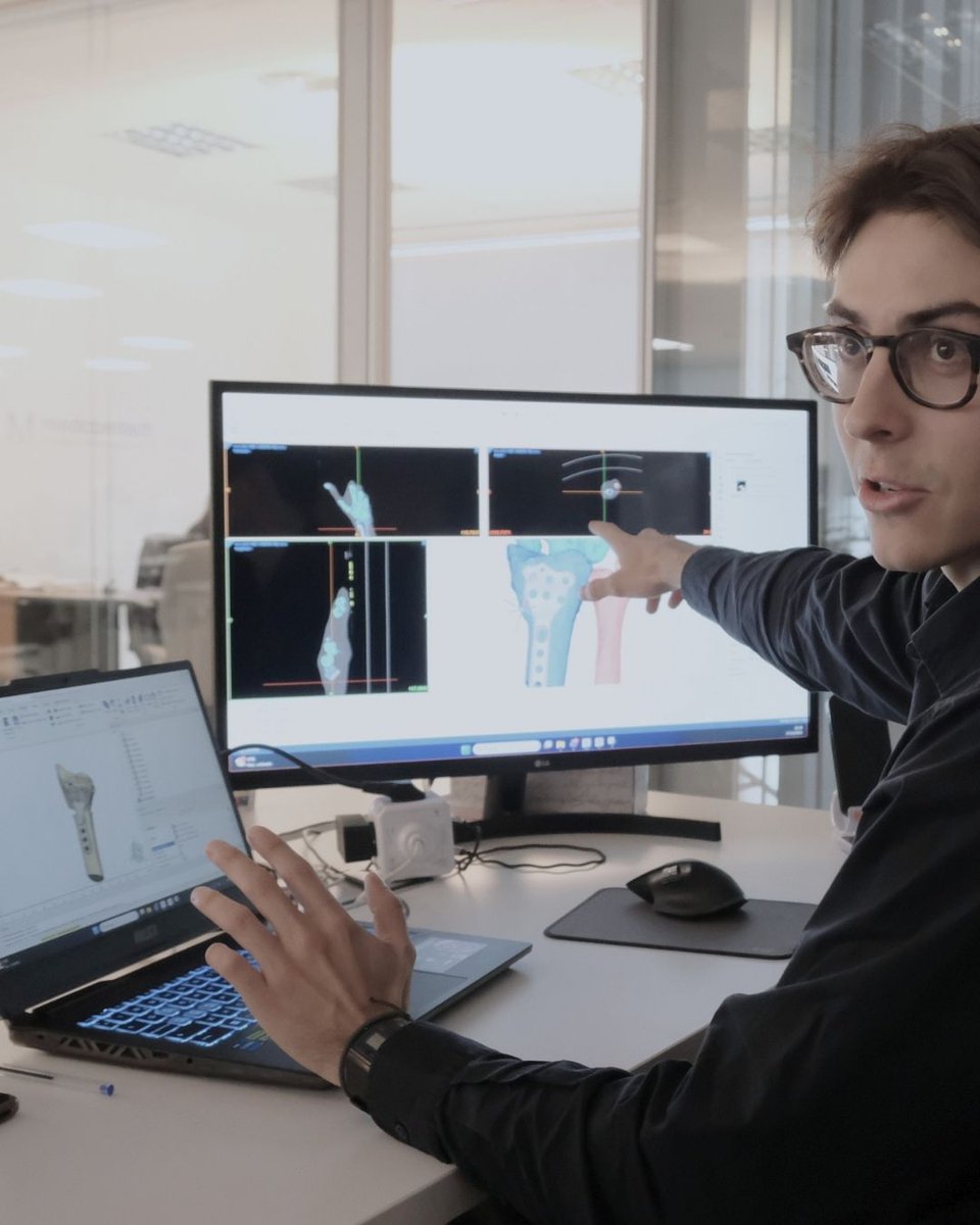 ValorImplant's tweet photo. When bone is missing, planning is not simply about filling a defect, but restoring a stable base for surgery. Depending on the case, options may include metallic augments, autograft with patient-specific guides, or allograft planning with physical models. https://t.co/RGY0B0JY3v