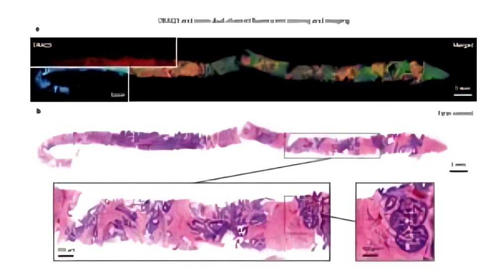 FindLightInc's tweet image. Light Sheet Microscopy (LSM) is transforming biomedical imaging—offering high-speed, low-phototoxic, 3D visualization of cells and tissues. Discover how it works and its real-world applications.
 findlight.net/blog/light-she…
#Microscopy #Biophotonics #MedTech