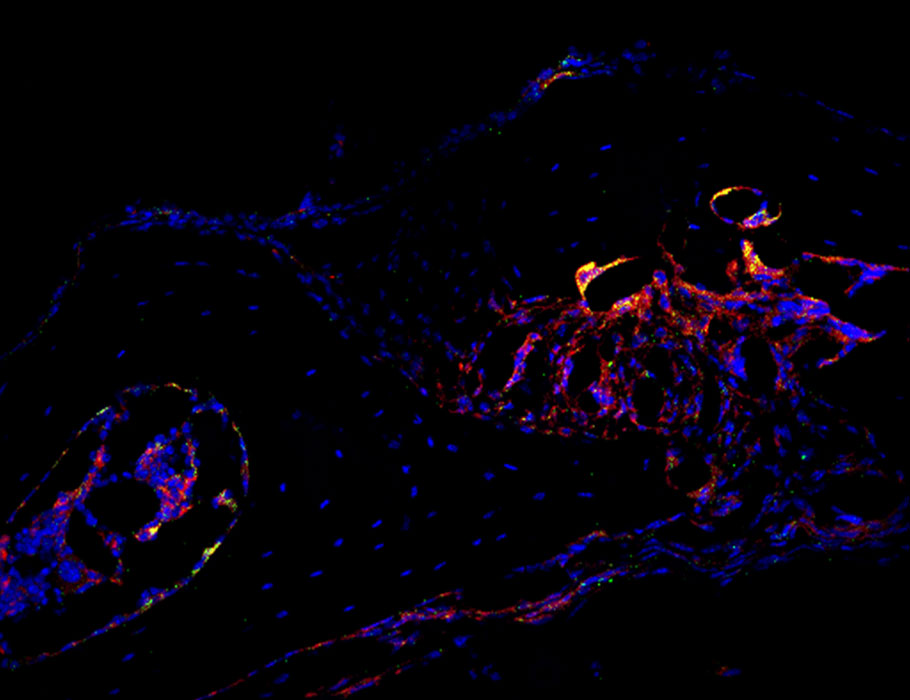 ScienceMagazine's tweet photo. Researchers have uncovered a pathway that keeps bone resorption in check by dampening the activation of #inflammasomes in osteoclasts—identifying an important restraint and helping to answer a paradox in the field of bone biology. @SciSignal https://t.co/tq48ePjxNK https://t.co/Uq67xZgh7O