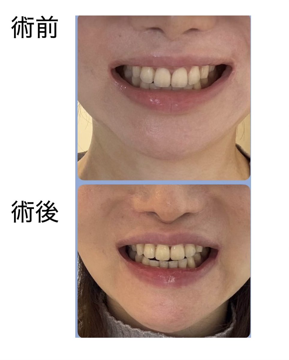 アゴ猫 tweet media