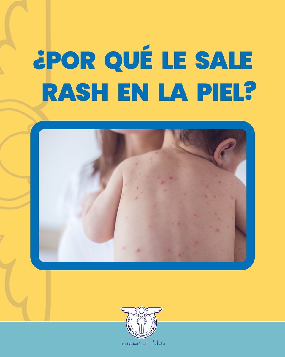 ASOPEDES's tweet photo. ¡No apliques cremas caseras a un rash sin antes observar! 🧴⚠️

Si el brote viene con fiebre, picazón intensa o decaimiento, necesitas un diagnóstico profesional, no un remedio casero. Evita complicaciones.

💬 MD o llámanos: ☎️ 2225-8281 https://t.co/cwa3qyoVV8