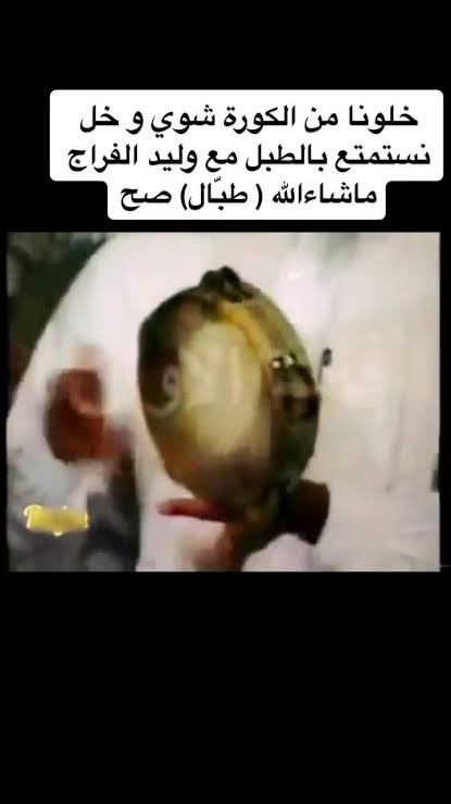 Yasser_5005 tweet media